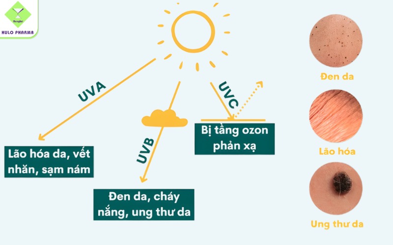 Tia UV được chia thành 3 loại chính