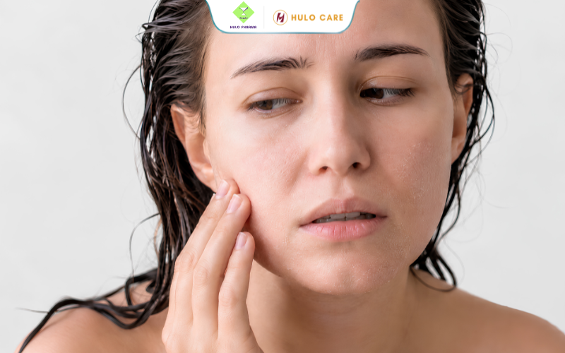 Rửa mặt xong da khô căng dù rửa sạch kin kít